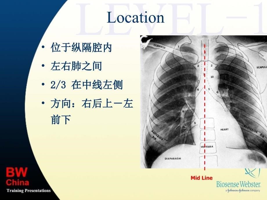 心脏解剖和传导系统：Basic Anatomy_第5页