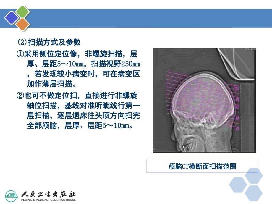 颅脑CT检查技术PPT课件_第5页