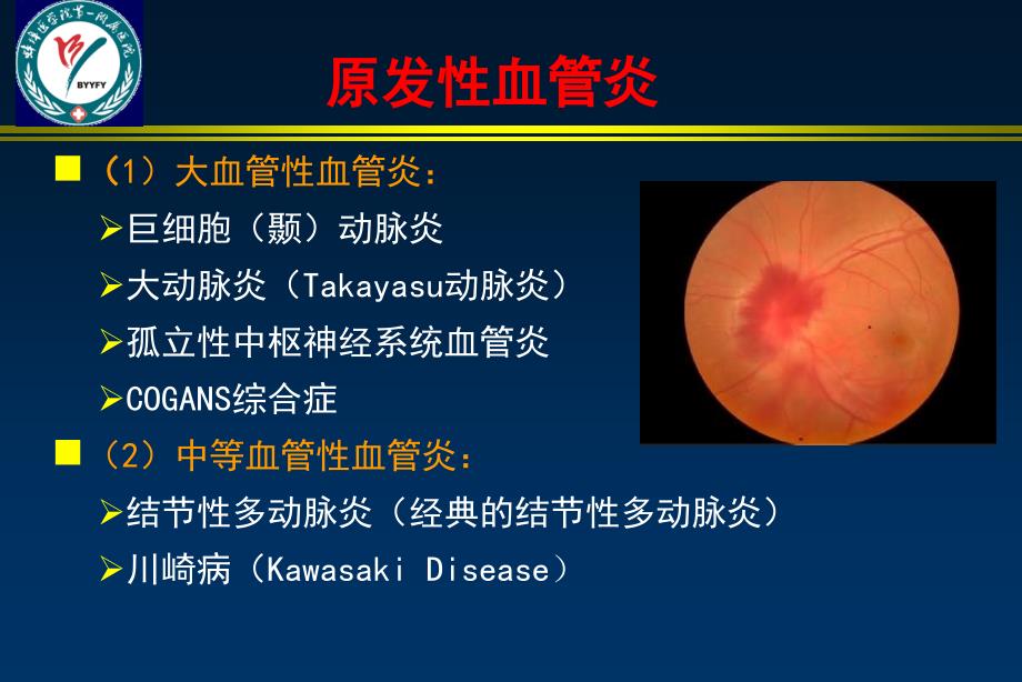 最新系统性血管炎_第4页