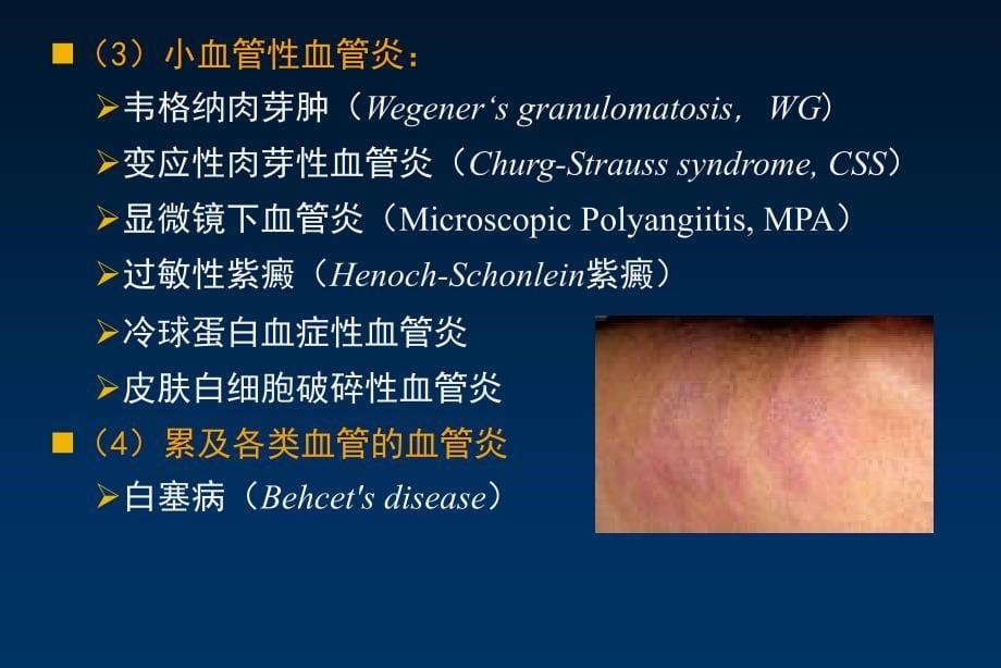 最新系统性血管炎_第5页