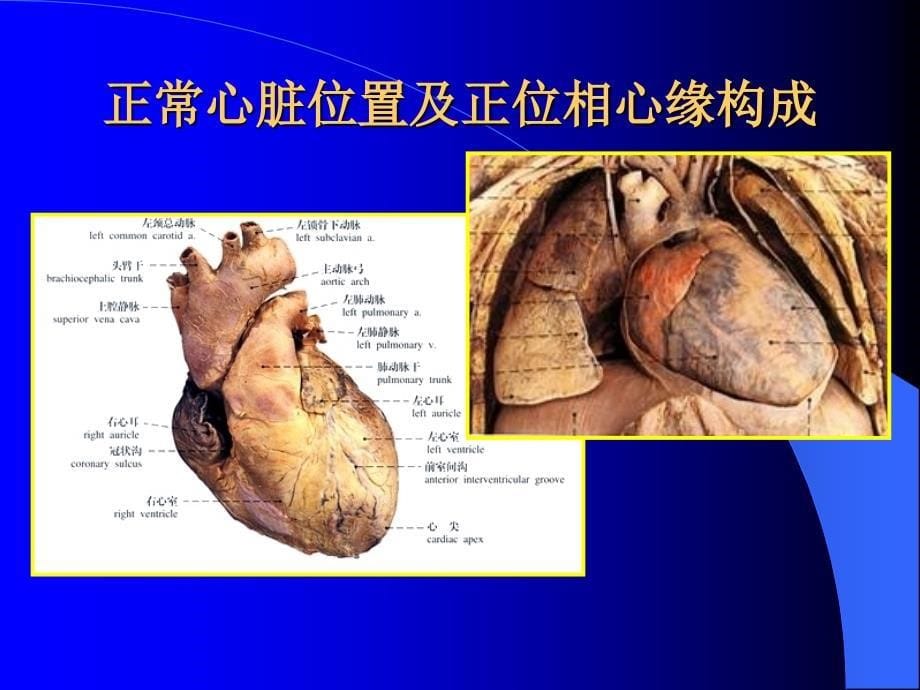 心脏与大血管-4版_第5页