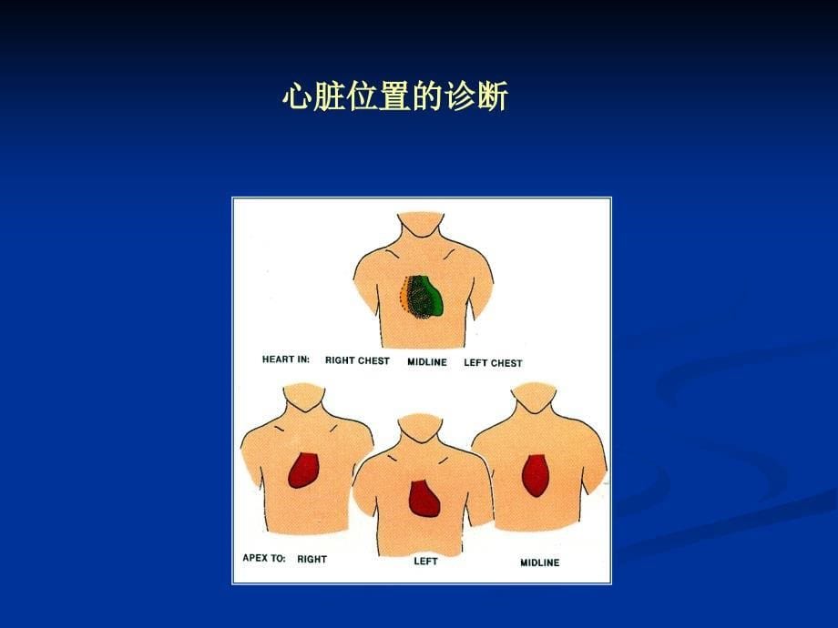 超声诊断学：先天性心脏病的超声诊断_第5页