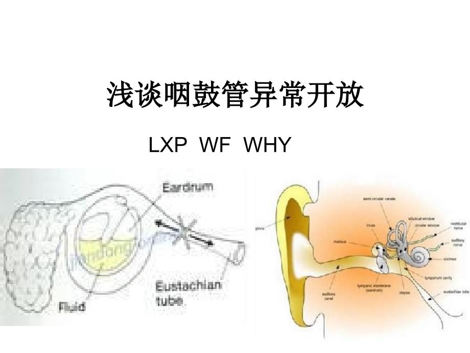 临床医学咽鼓管异常开放演示文稿_第1页