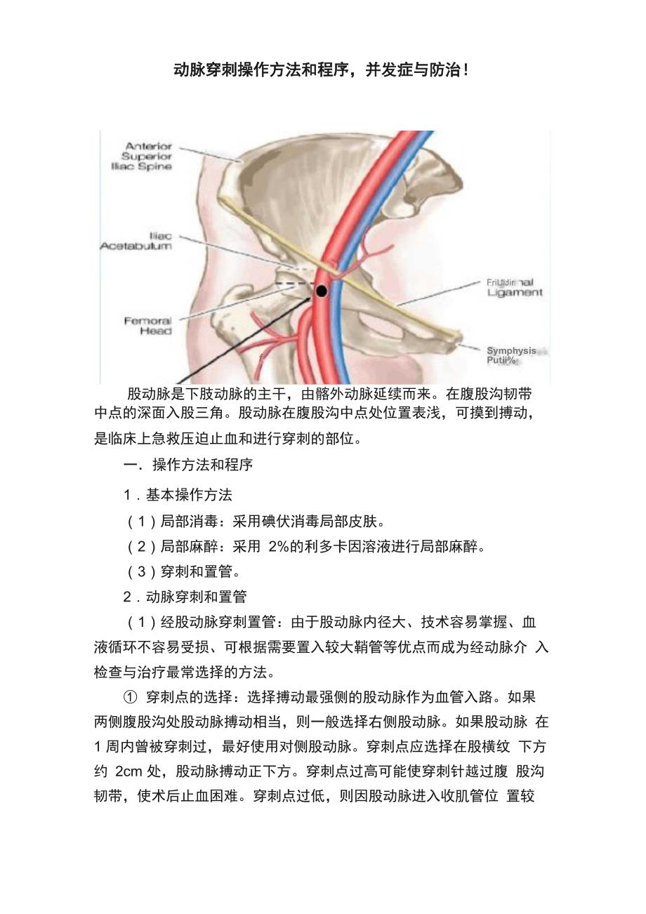 股动脉穿刺操作方法和程序并发症与防治！_第1页