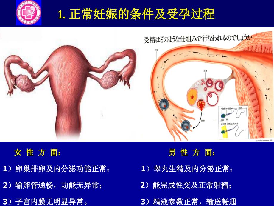 不孕与助孕ppt课件_第4页