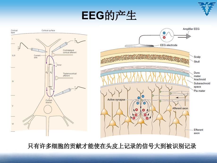 神经生物学课件：8脑的节律与睡眠-5年制_第5页