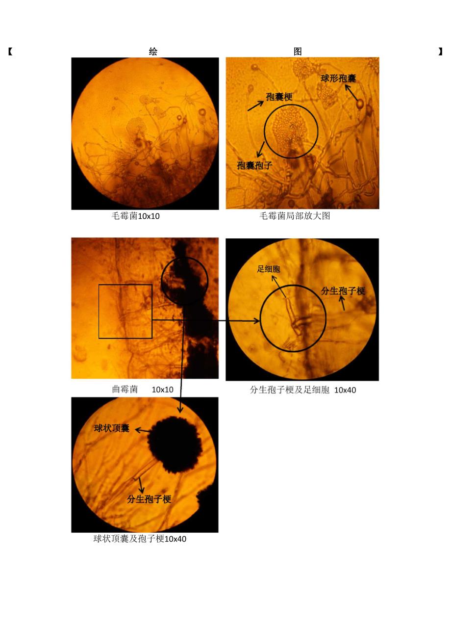 霉菌观察实验报告_第3页