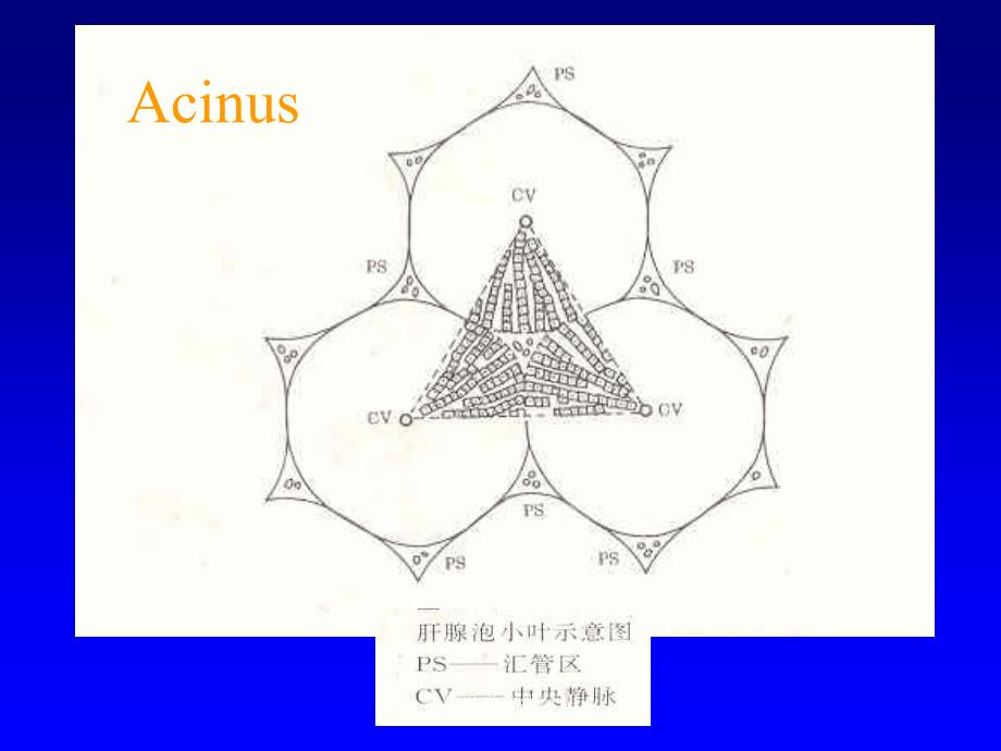 最新慢性肝炎分级分期_第4页