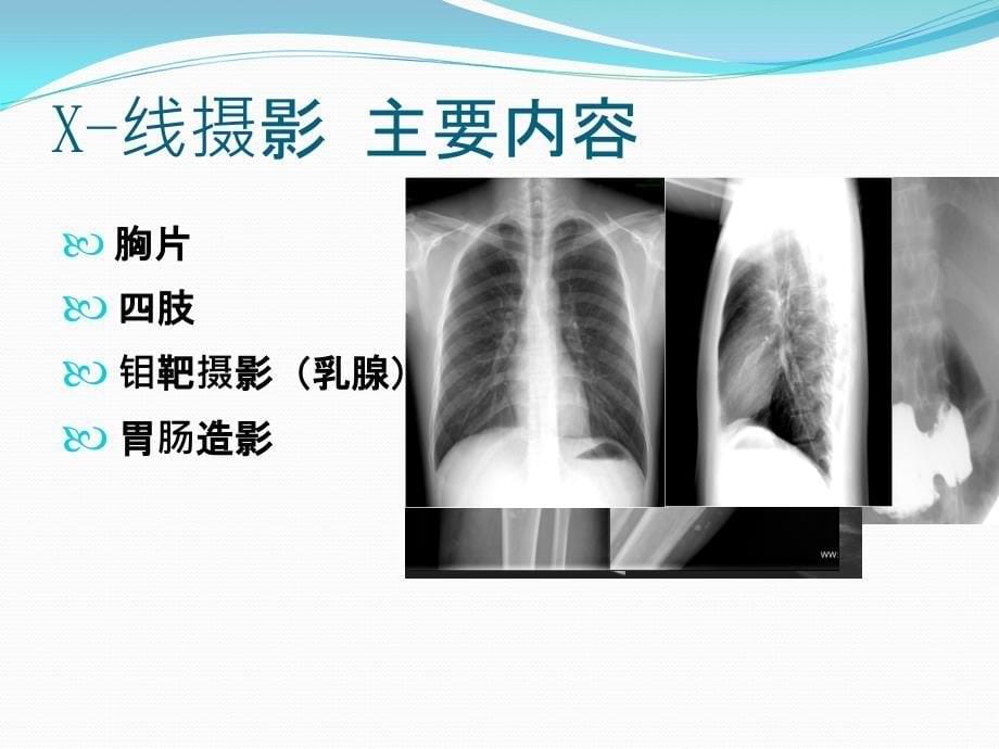 合理选择影像检查方法_第5页