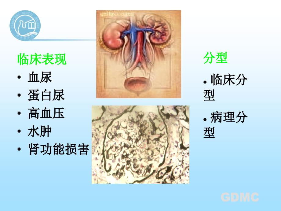 内科学教学课件：原发性肾小球疾病_第2页