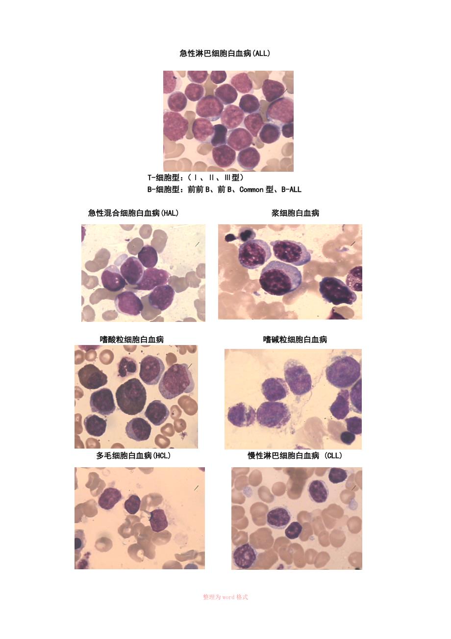 造血干细胞分化图_第4页