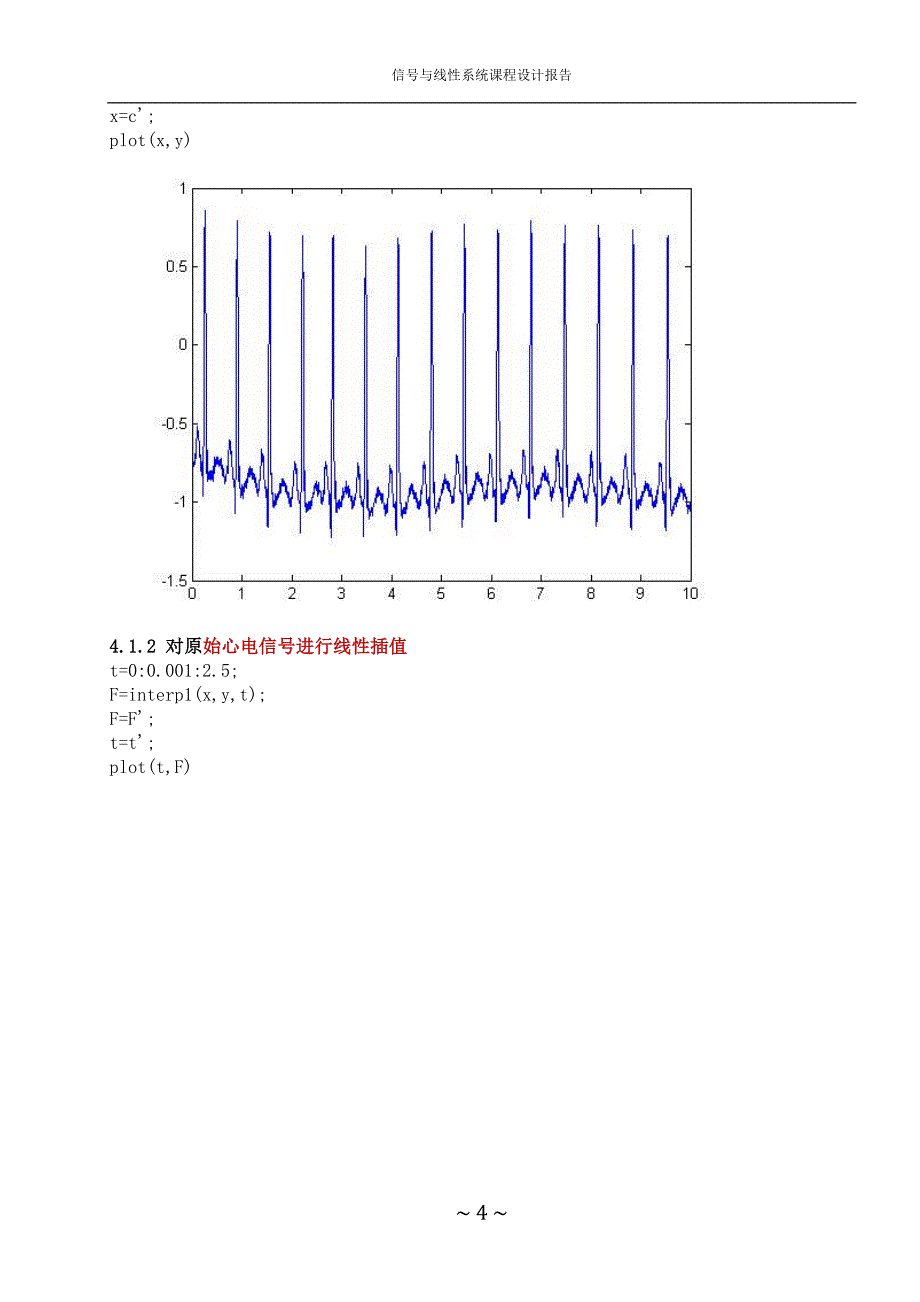 基于MATLAB的心电信号分析系统的设计与仿真_第4页