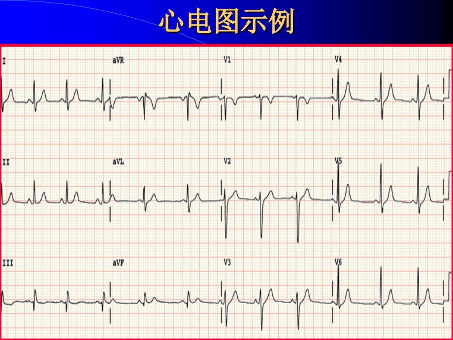 《诊断学》课件：正常心电图_第4页