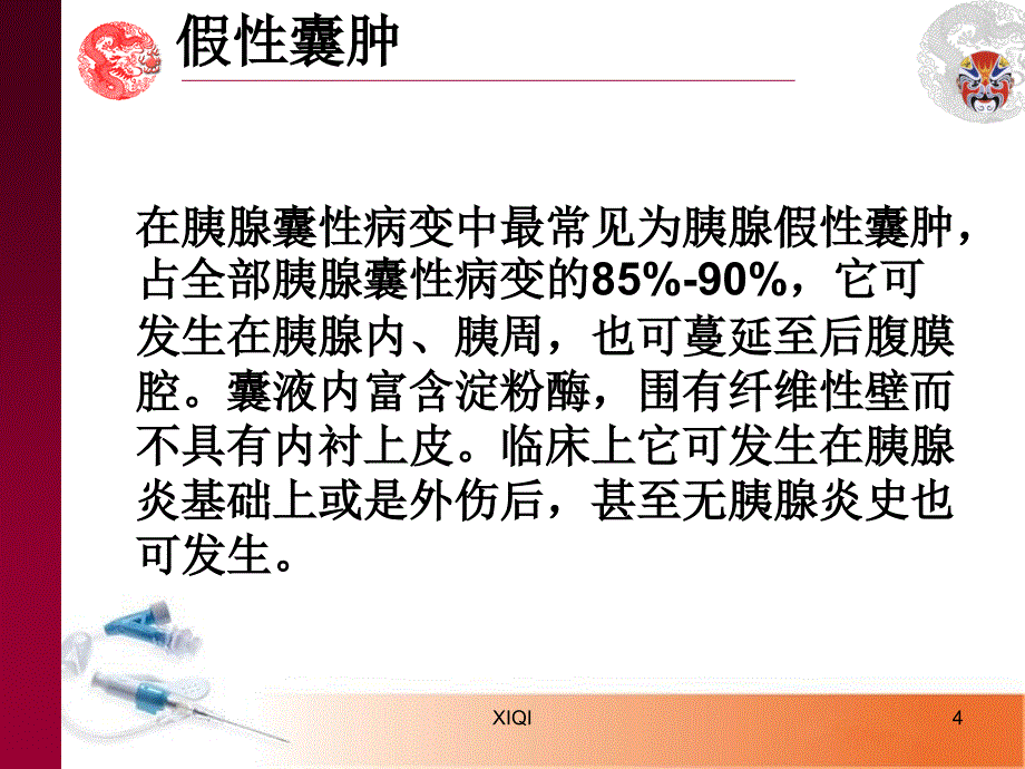 胰腺囊性病变_第4页