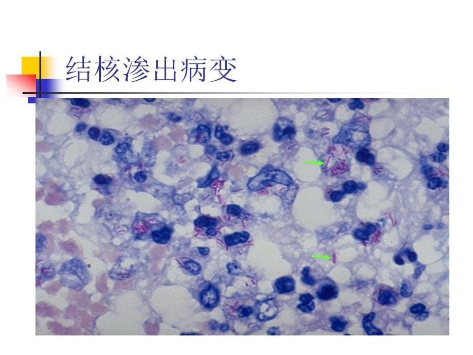 实验九 传染病与寄生虫病_第5页