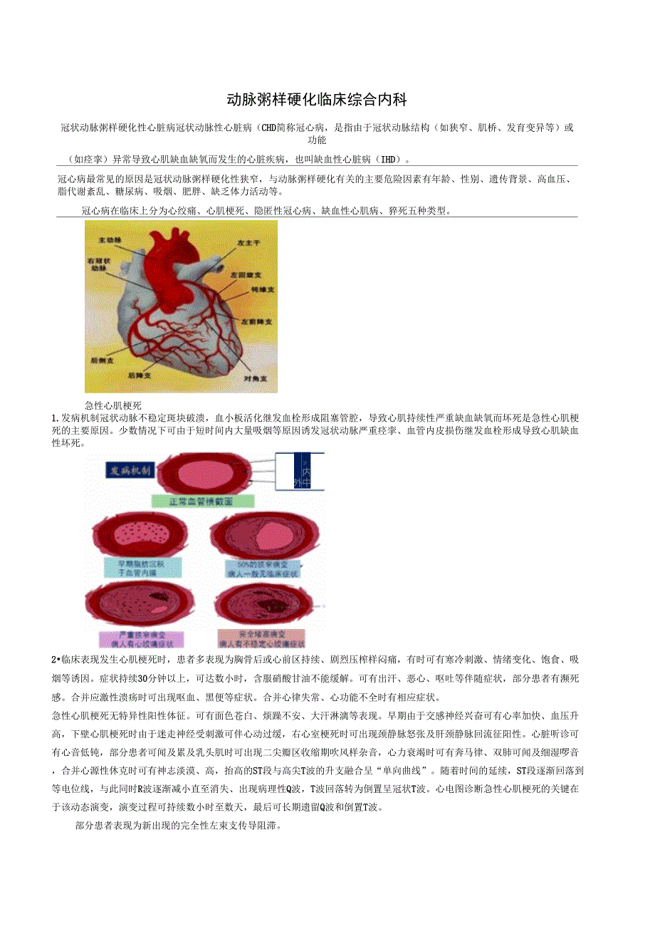 动脉粥样硬化临床综合内科_第1页