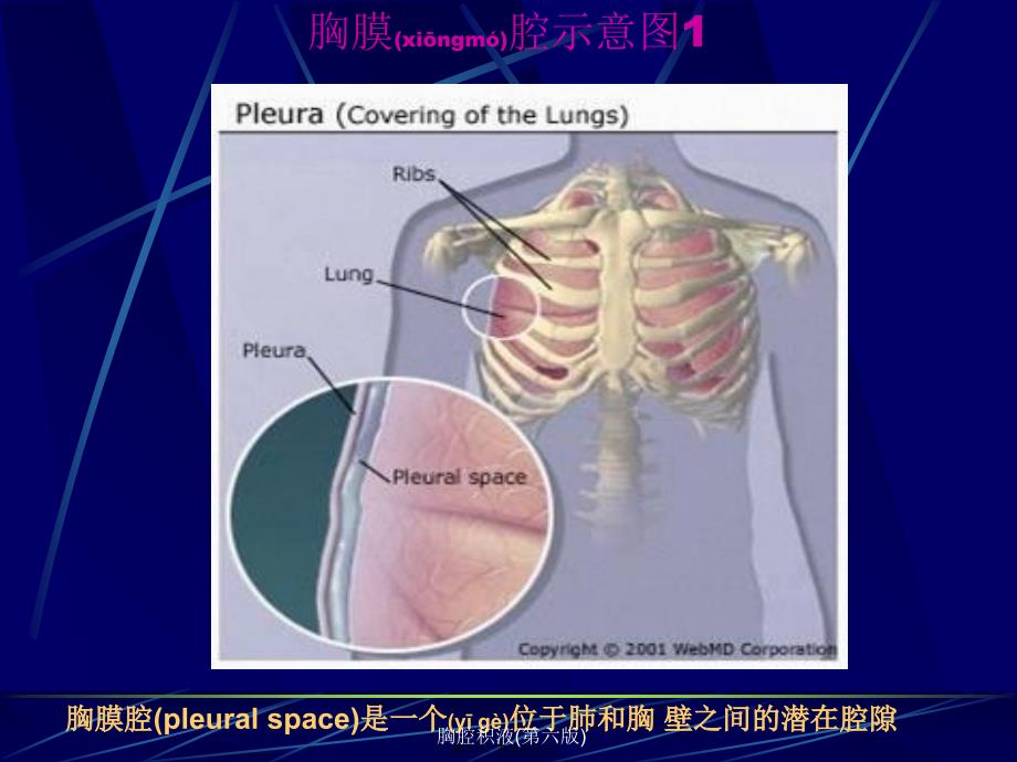 胸腔积液(第六版)课件_第2页