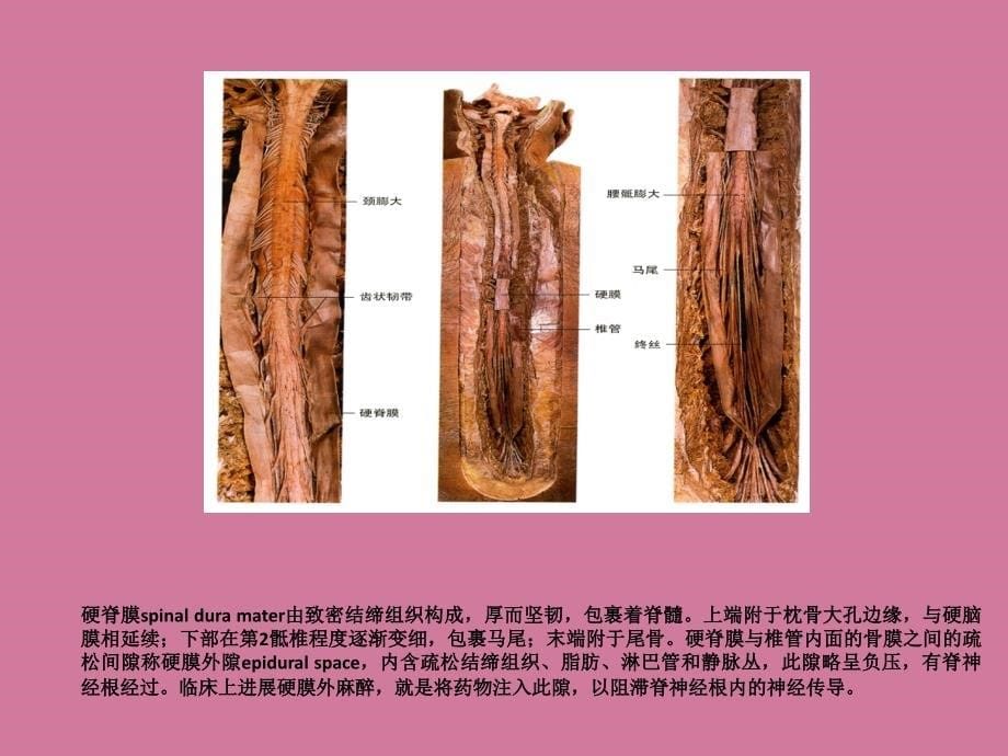 脑的血氧供应PPT课件_第5页