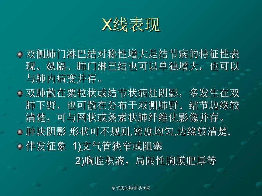 最新结节病的影像学诊断_第5页