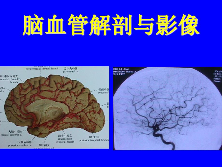 颈内动脉解剖_第1页