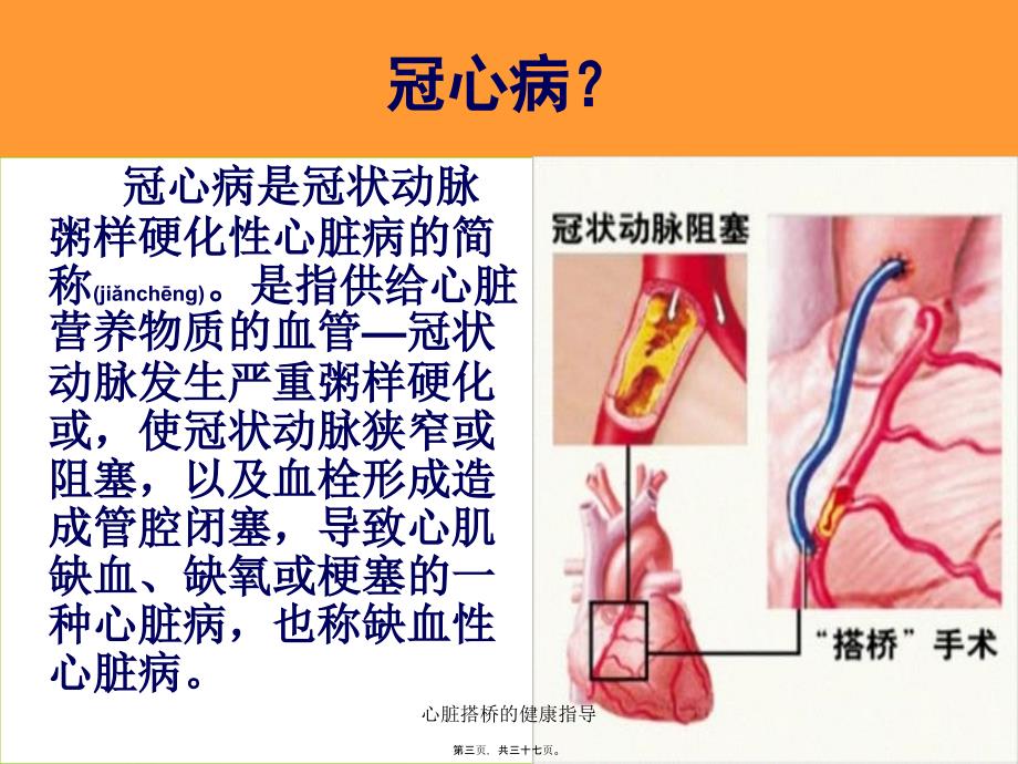 心脏搭桥的健康指导课件_第3页