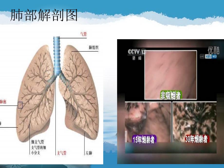 COPD呼衰护理查房_第4页