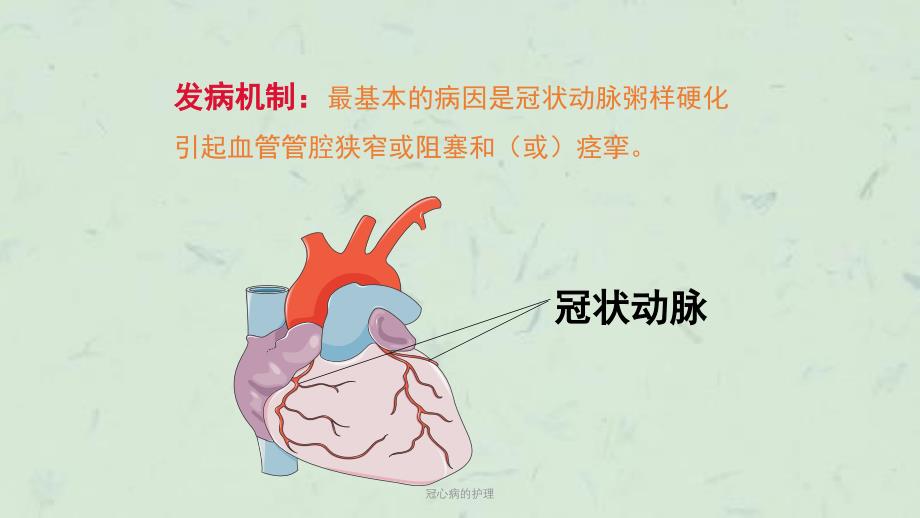 冠心病的护理 课件_第4页