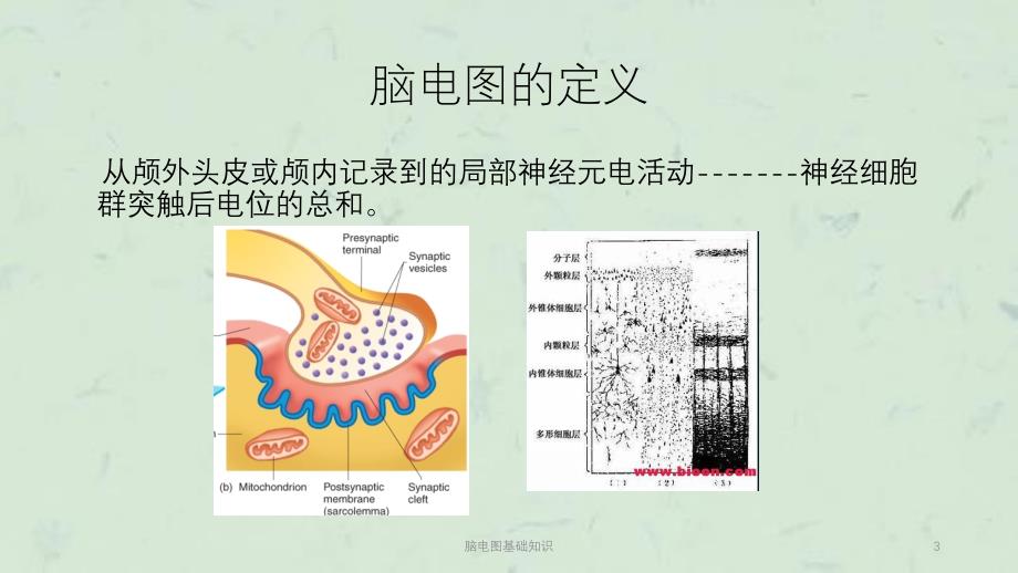 脑电图基础知识课件_第3页