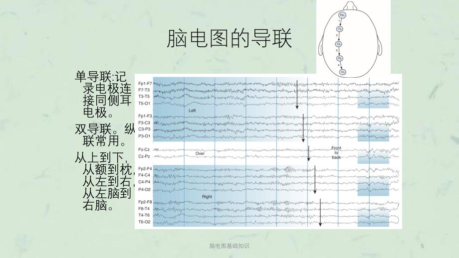 脑电图基础知识课件_第5页