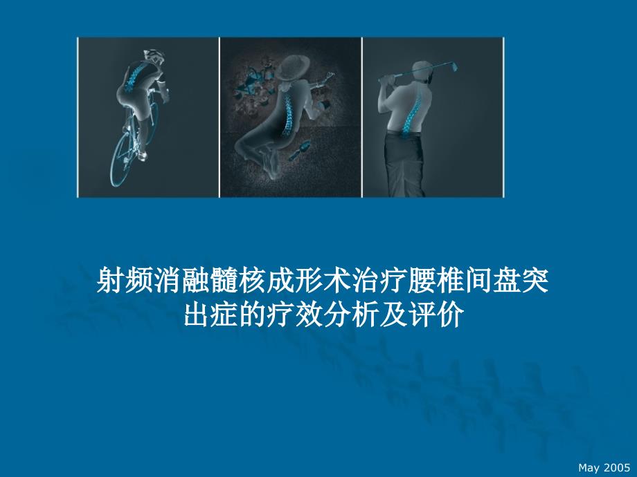 医学交流课件：射频消融髓核成形术治疗腰椎间盘突出症的疗效分析及评价_第1页