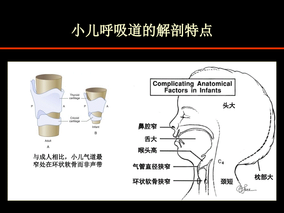 唇腭裂麻醉进展_第4页