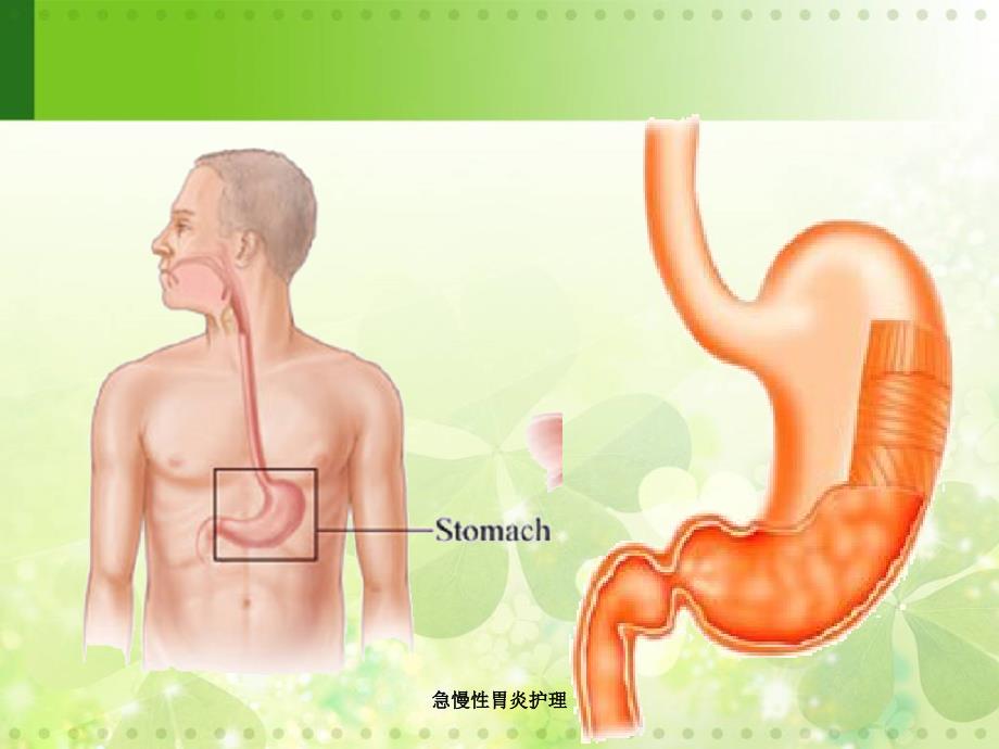 最新急慢性胃炎护理_第4页