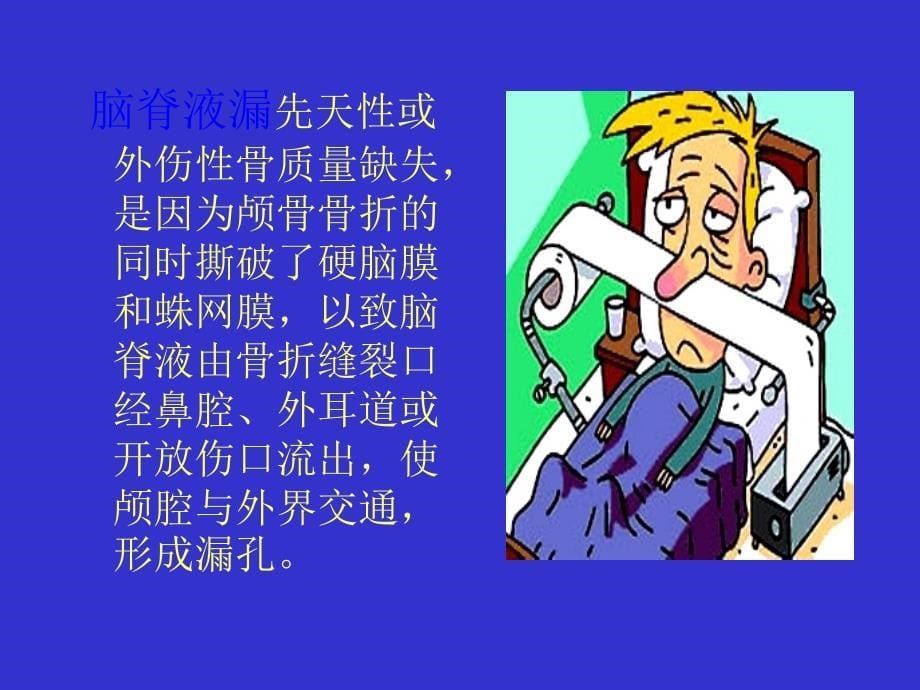 脑脊液漏的护理及健康教育ppt课件_第5页