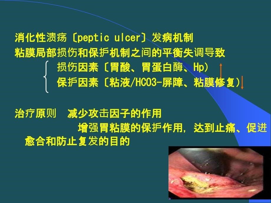 36抗消化性溃疡药sunppt课件_第5页