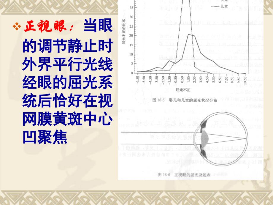 屈光不正和老视病人的护理.ppt_第4页