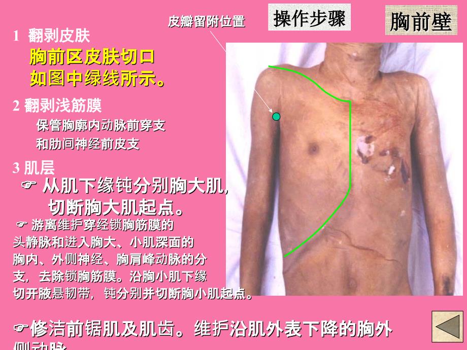 局解操作上肢ppt课件_第2页