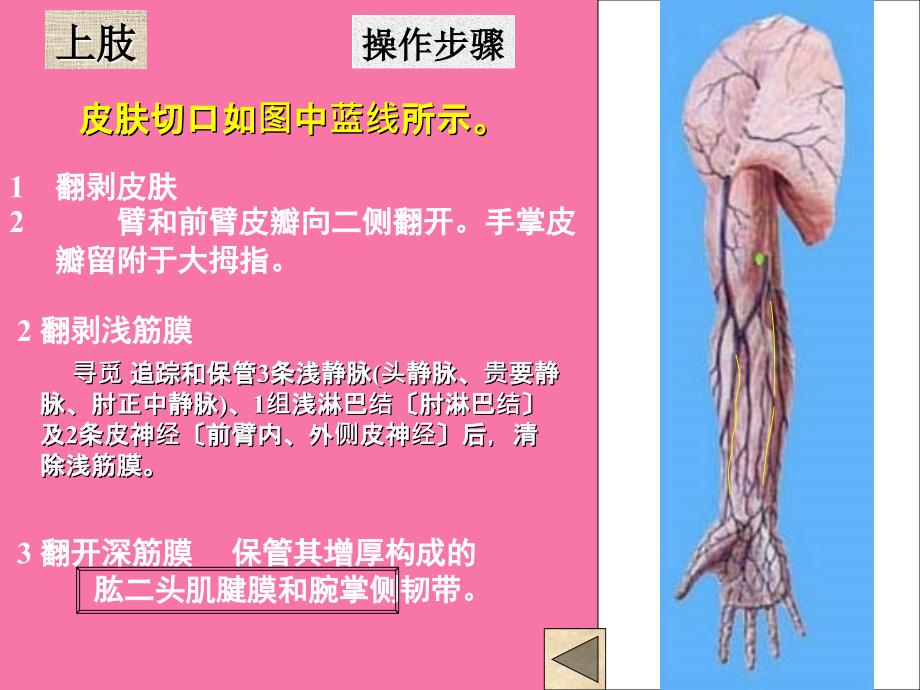 局解操作上肢ppt课件_第3页