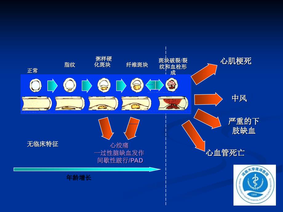 心肌梗死全球统一定义更新解读_第2页