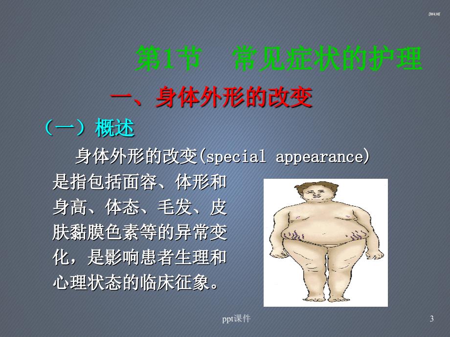 内科护理学内分泌与代谢疾病患者的护理ppt课课件_第3页