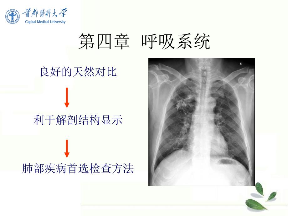 《影像诊断学》教学课件：呼吸系统第一节 检查方法_第2页