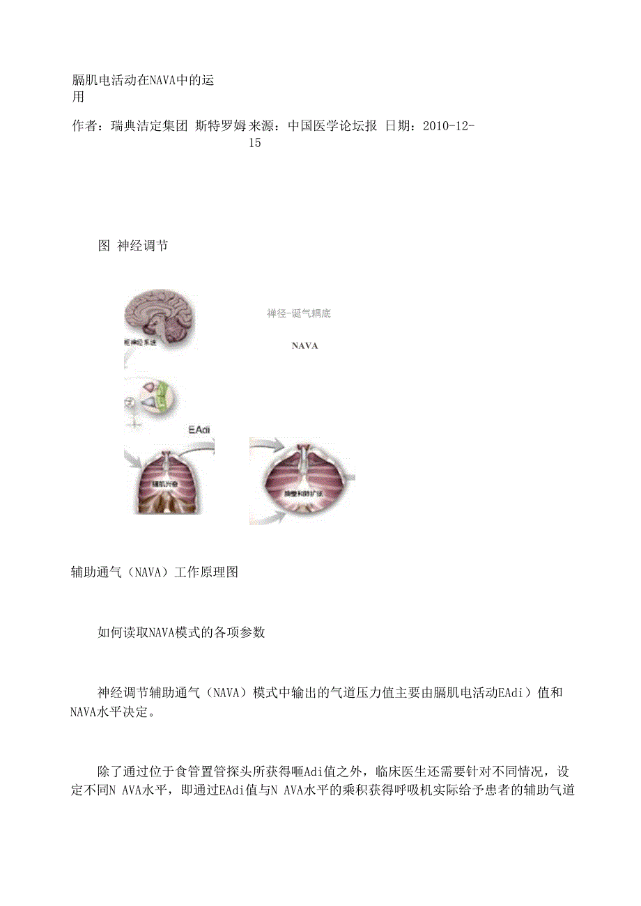 膈肌电活动在NAVA中的运用_第1页