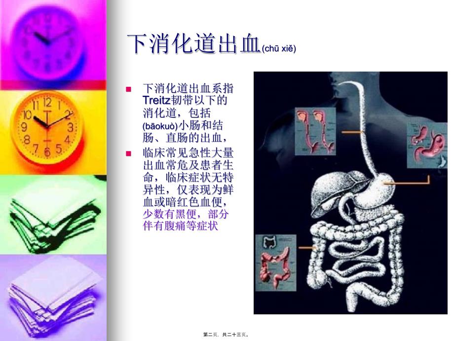 医学专题—下消化道出血+腹痛28602_第2页