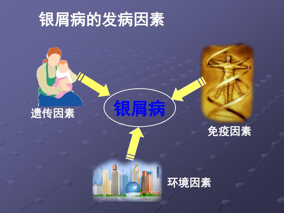 银屑病再认识.ppt_第2页