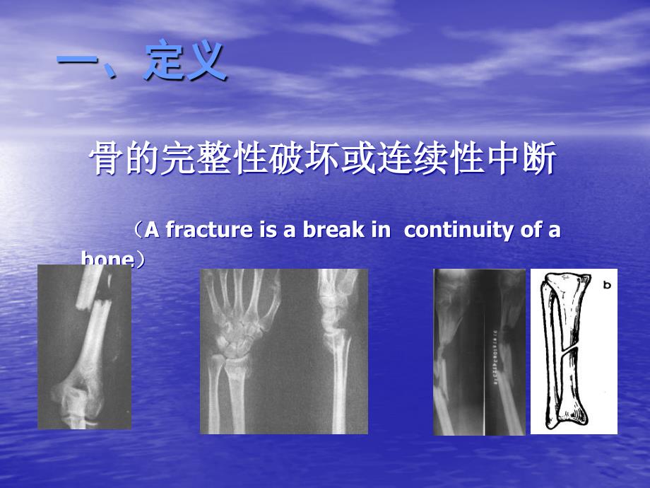 运动系统疾病_第3页