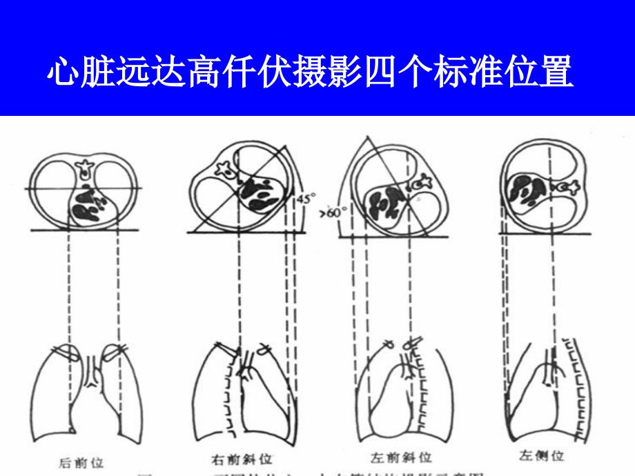 临床本科循环系统实习片库_第3页