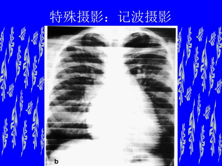 临床本科循环系统实习片库_第4页