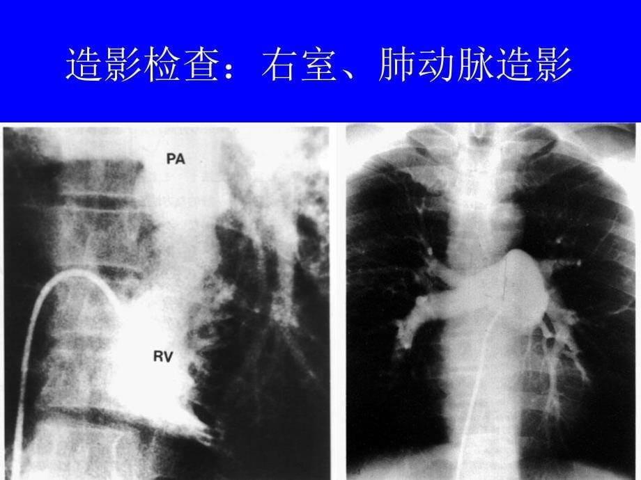 临床本科循环系统实习片库_第5页