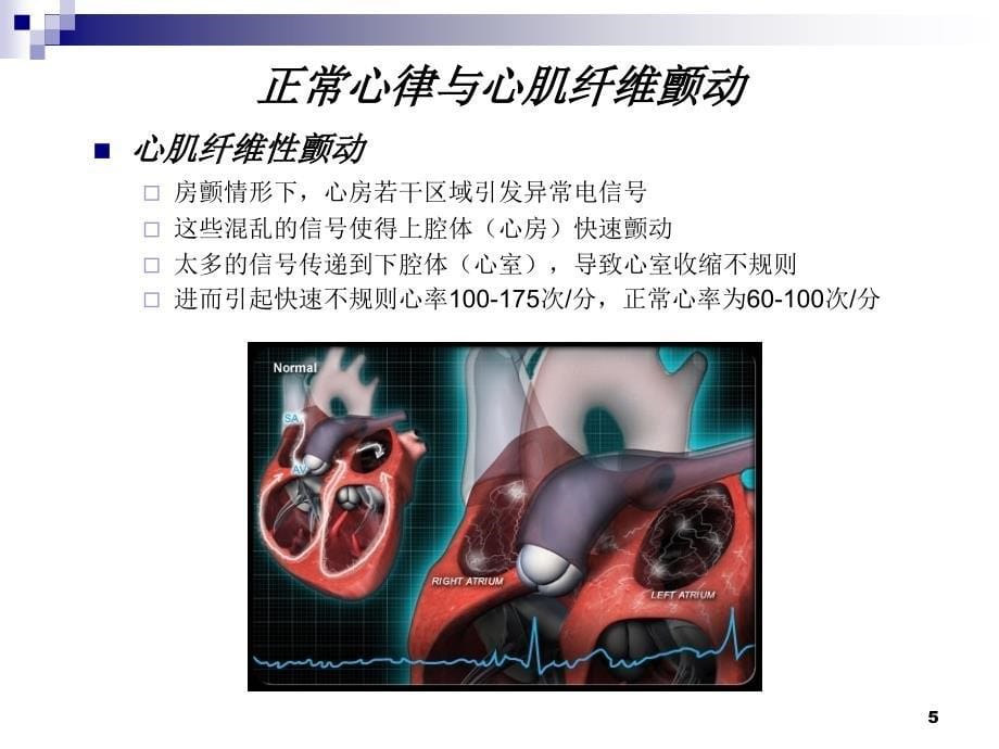 房颤病因检查与治疗ppt课件_第5页