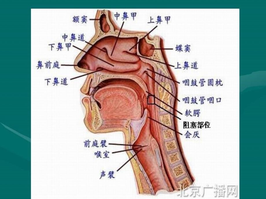 OSAHS睡眠呼吸暂停_第5页