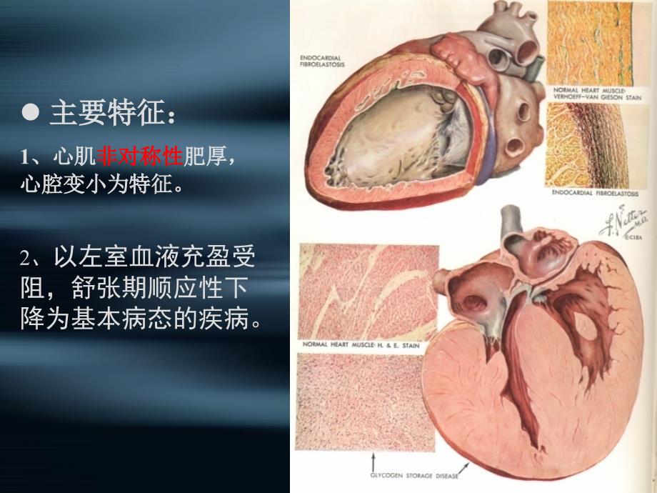 第八章心肌病二_第2页